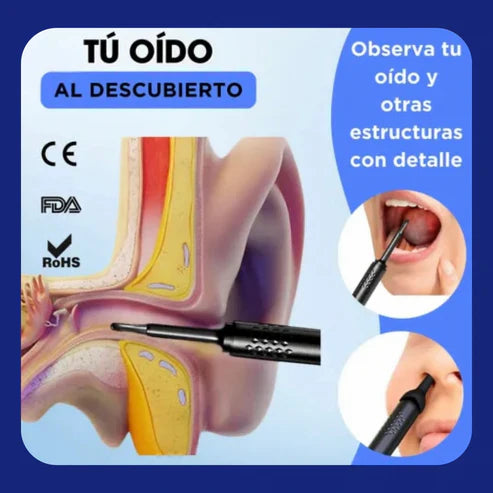 Audiscope Pro™ – Dile Adiós a la Cera con Precisión y Seguridad